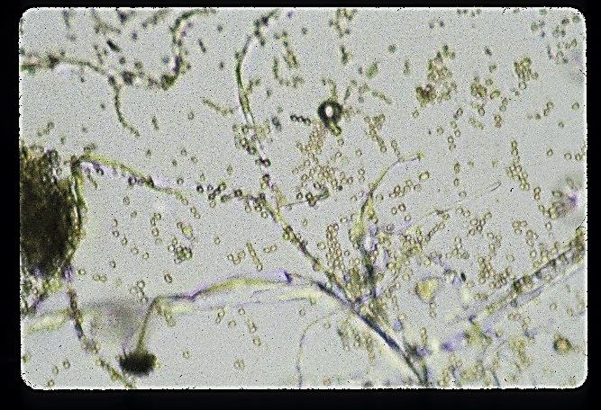 File:Mold5.jpg