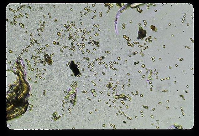 File:Mold6.jpg