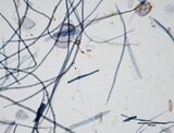 Rice pulp at 400x showing fibers, serrated epidermal cells, barrel-shaped parenchyma and other vessel elements.