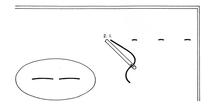 File:TSG-DHS-stabstitch.jpg