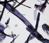 Oat pulp at 400x showing serrated epidermal cells and other vessel element.