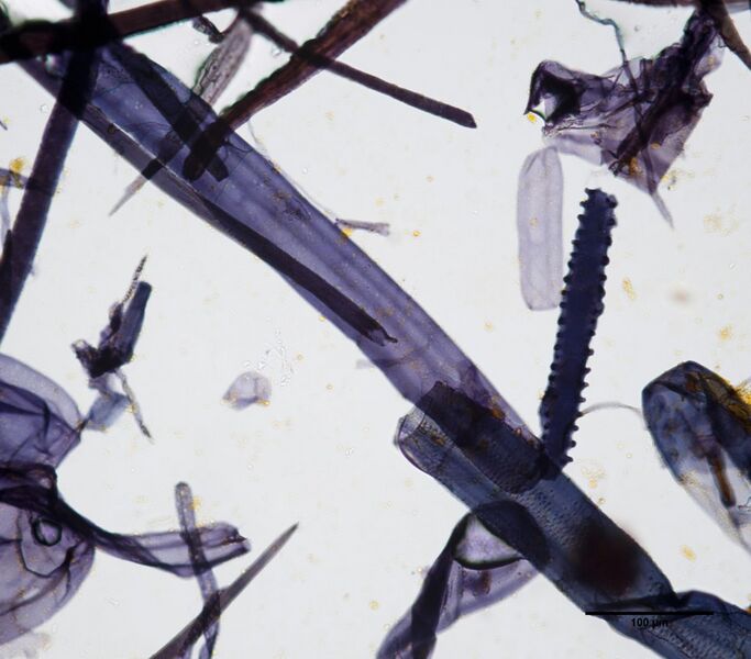 File:Oat 40x serratedepi.jpg