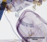Oat pulp at 400x showing unwound spiral thickenings and other vessel elements.