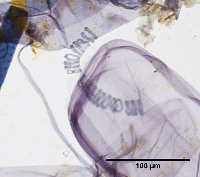 File:Oat 40x unwoundspirals.jpg