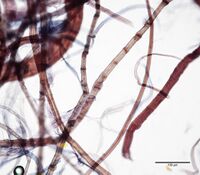 Photomicrograph showing flax bast fibers with shive at 400x.