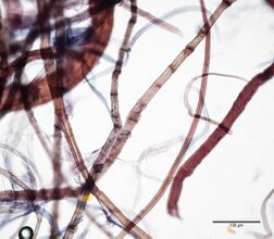 Flax bast fibers with shive. Sample stained with Graff "C" stain.