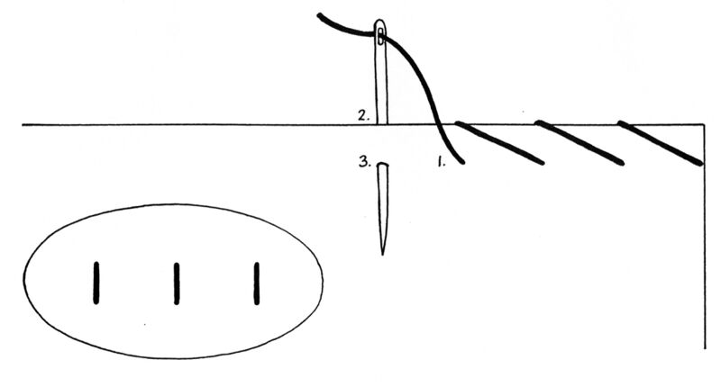 File:TSG-DHS-overcaststitch.jpg