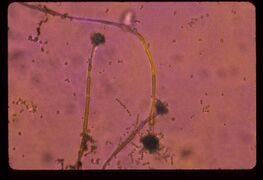 Magnified mold. Photo by Ann Baldwin.