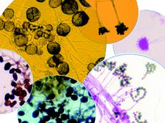 Magnified mold and mold spores. Image courtesy of the EPA.