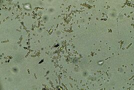 Magnified mold. Photo by Ann Baldwin.