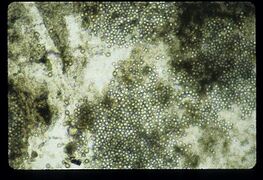 Magnified mold. Photo by Ann Baldwin.