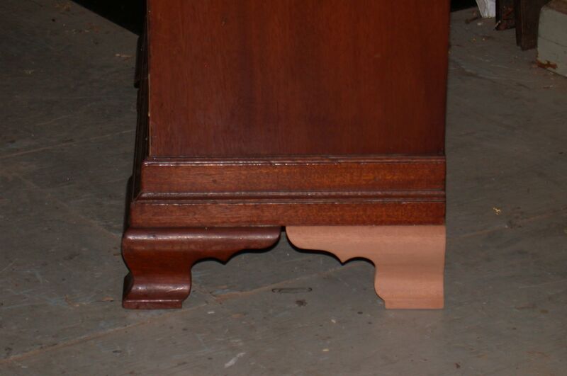 File:Loss compensation of foot.jpeg