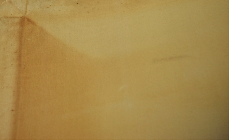 File:Stretcher burn.png